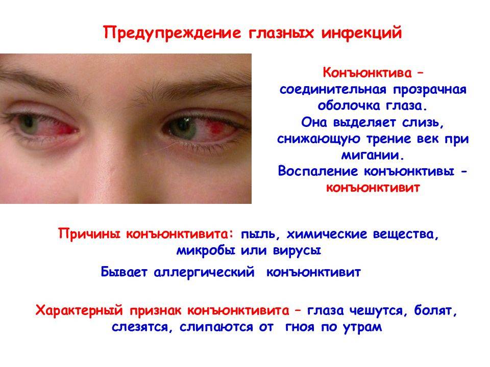 Глазной тик: причины, симптомы, способы лечения – эл клиника