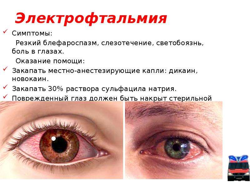 Почему могут болеть глаза и как это исправить