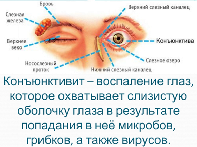 Боль в глазах. боль в глазном яблоке. лечение глазной боли в клинике «эхинацея». нейроофтальмолог